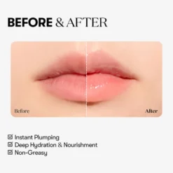 Reedle Shot Lip Plumper Beginner